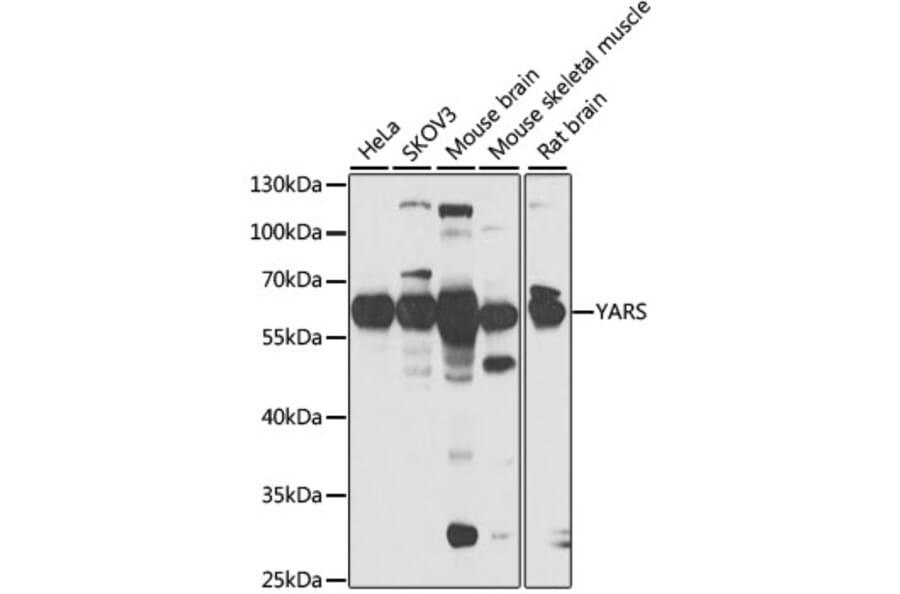 Western Blot - Anti-Tyrosyl tRNA synthetase/TyrRS Antibody (A15383) - Antibodies.com
