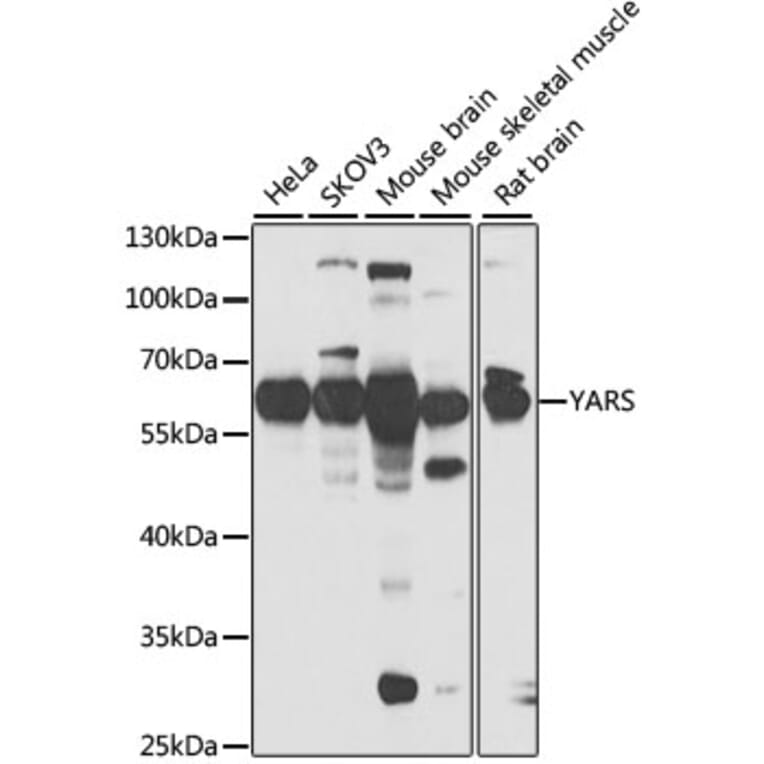 Western Blot - Anti-Tyrosyl tRNA synthetase/TyrRS Antibody (A15383) - Antibodies.com