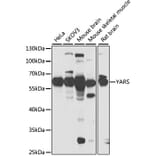 Western Blot - Anti-Tyrosyl tRNA synthetase/TyrRS Antibody (A15383) - Antibodies.com