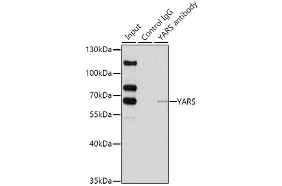 Western Blot - Anti-Tyrosyl tRNA synthetase/TyrRS Antibody (A15383) - Antibodies.com