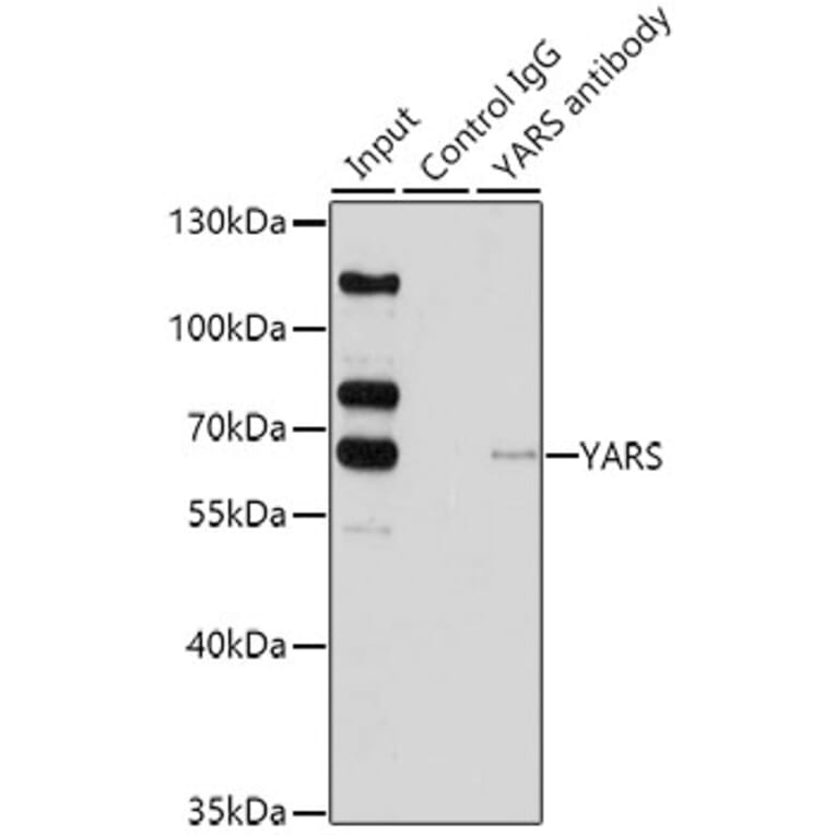 Western Blot - Anti-Tyrosyl tRNA synthetase/TyrRS Antibody (A15383) - Antibodies.com