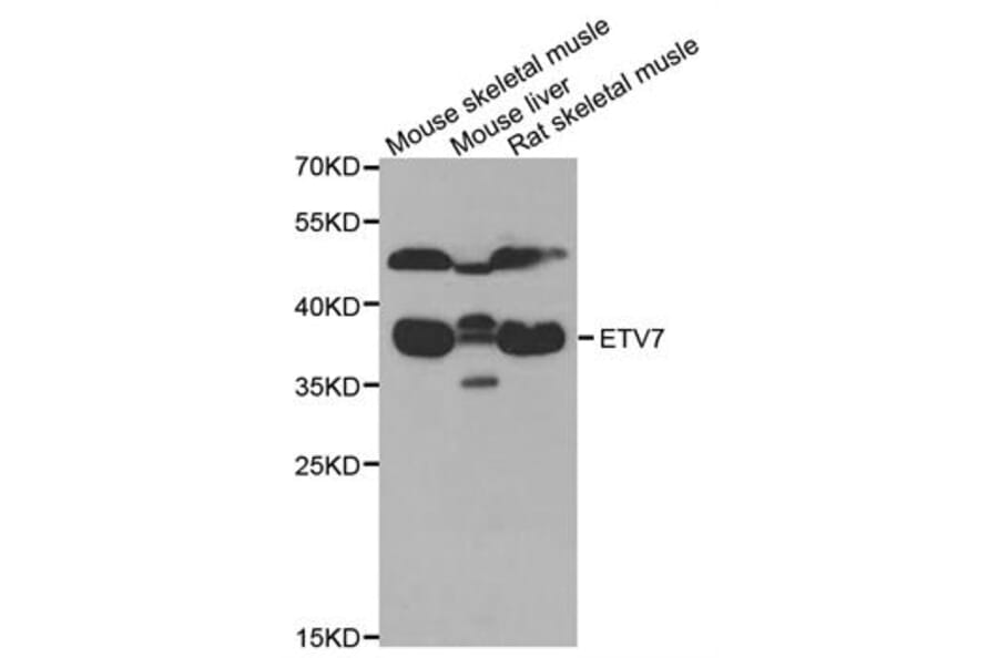 Western Blot - Anti-ETV7 Antibody (A6794) - Antibodies.com