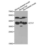 Western Blot - Anti-ETV7 Antibody (A6794) - Antibodies.com