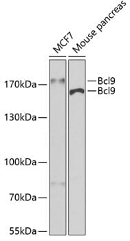 Western blot analysis of extracts of various cell lines, using Anti-Bcl9 Antibody (A6795) at 1:400 dilution.
Secondary antibody: Goat Anti-Rabbit IgG (H+L) (HRP) (AS014) at 1:10,000 dilution.
Lysates / proteins: 25µg per lane.
Blocking buffer: 3% non-fat dry milk in TBST.
Detection: ECL Basic Kit (RM00020).
Exposure time: 30s.