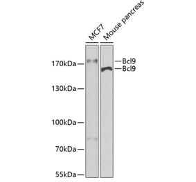 Western Blot - Anti-BCL9 Antibody (A15386) - Antibodies.com