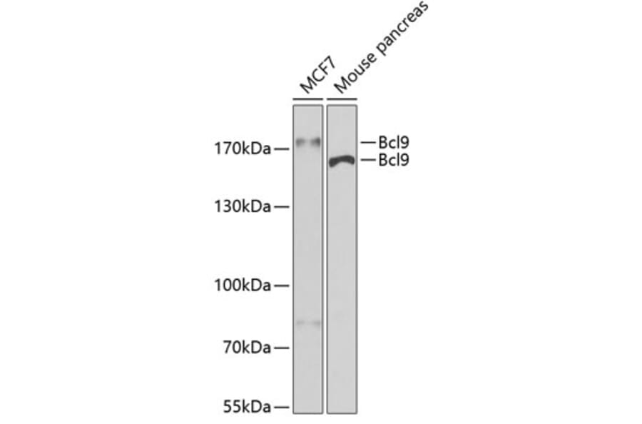 Western Blot - Anti-BCL9 Antibody (A15386) - Antibodies.com