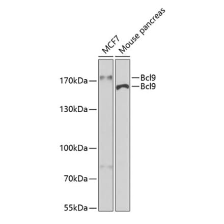 Western Blot - Anti-BCL9 Antibody (A15386) - Antibodies.com