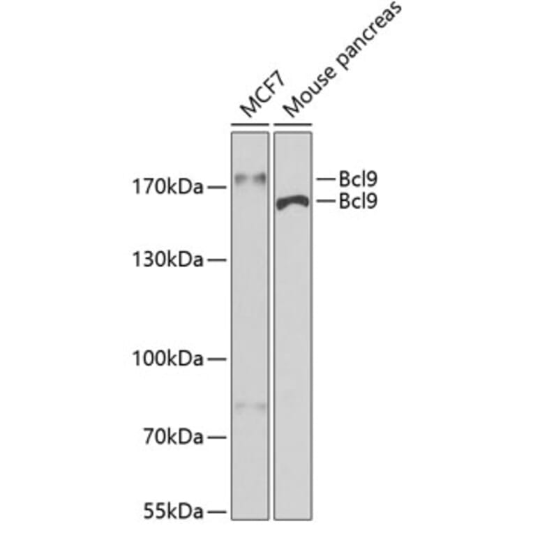 Western Blot - Anti-BCL9 Antibody (A15386) - Antibodies.com