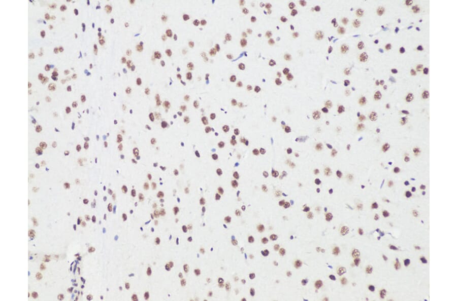 Immunohistochemistry - Anti-BCL9 Antibody (A15386) - Antibodies.com