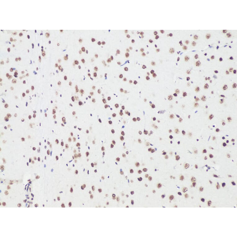 Immunohistochemistry - Anti-BCL9 Antibody (A15386) - Antibodies.com