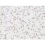 Immunohistochemistry - Anti-BCL9 Antibody (A15386) - Antibodies.com