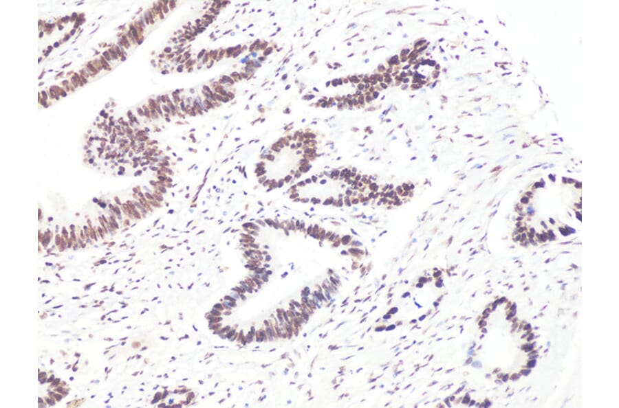 Immunohistochemistry - Anti-BCL9 Antibody (A15386) - Antibodies.com