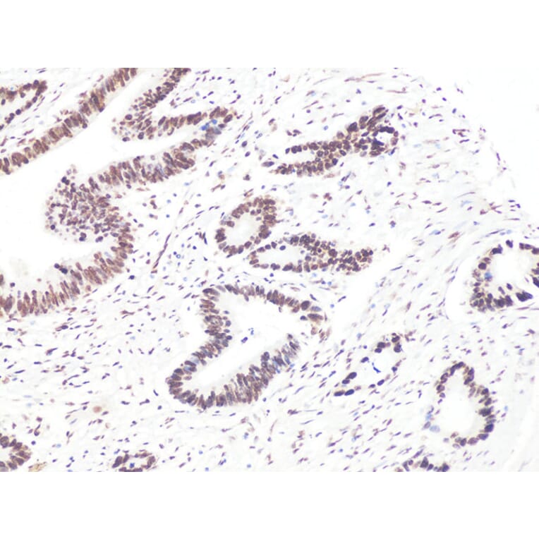 Immunohistochemistry - Anti-BCL9 Antibody (A15386) - Antibodies.com