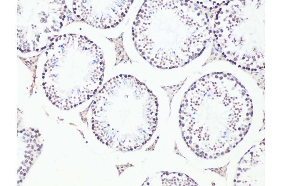 Immunohistochemistry - Anti-BCL9 Antibody (A15386) - Antibodies.com