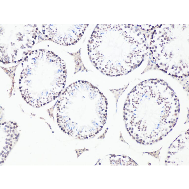 Immunohistochemistry - Anti-BCL9 Antibody (A15386) - Antibodies.com