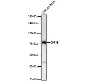 Western Blot - Anti-CPT1B Antibody (A15387) - Antibodies.com