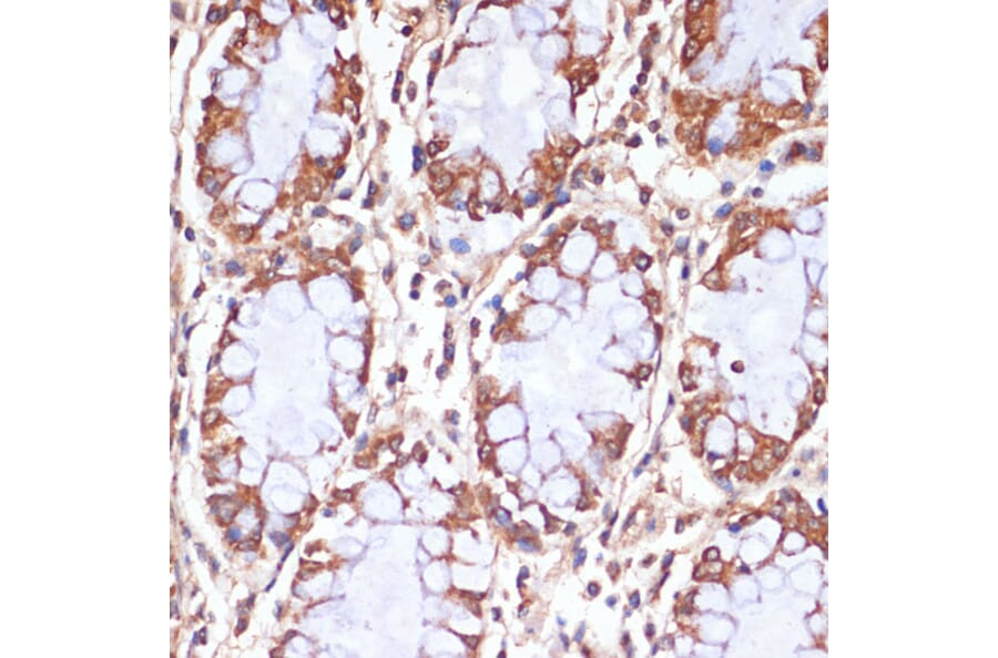 Immunohistochemistry - Anti-CPT1B Antibody (A15387) - Antibodies.com