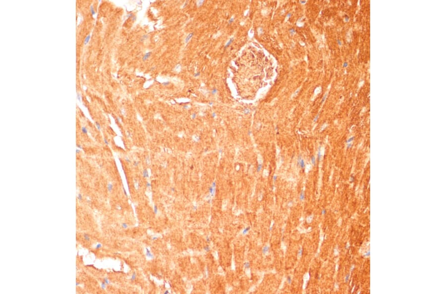 Immunohistochemistry - Anti-CPT1B Antibody (A15387) - Antibodies.com