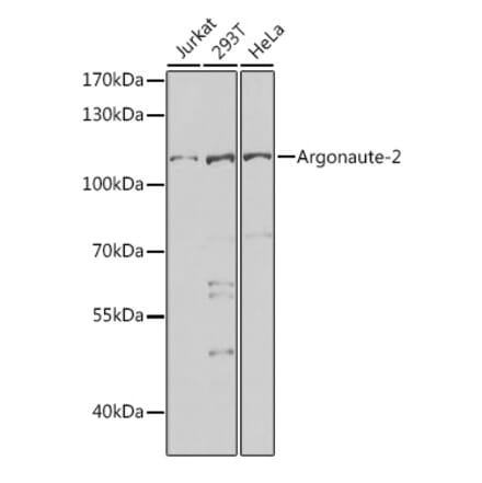 Western Blot - Anti-Argonaute-2 Antibody (A15388) - Antibodies.com