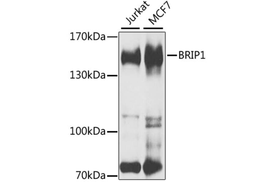 Western Blot - Anti-BACH1/BRIP1 Antibody (A15389) - Antibodies.com