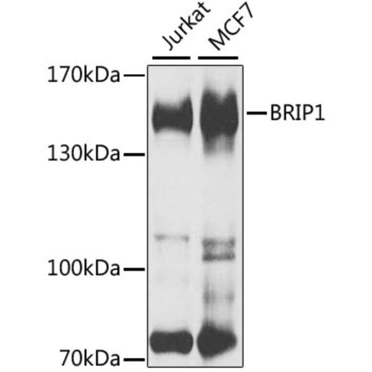 Western Blot - Anti-BACH1/BRIP1 Antibody (A15389) - Antibodies.com