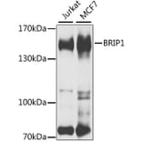 Western Blot - Anti-BACH1/BRIP1 Antibody (A15389) - Antibodies.com