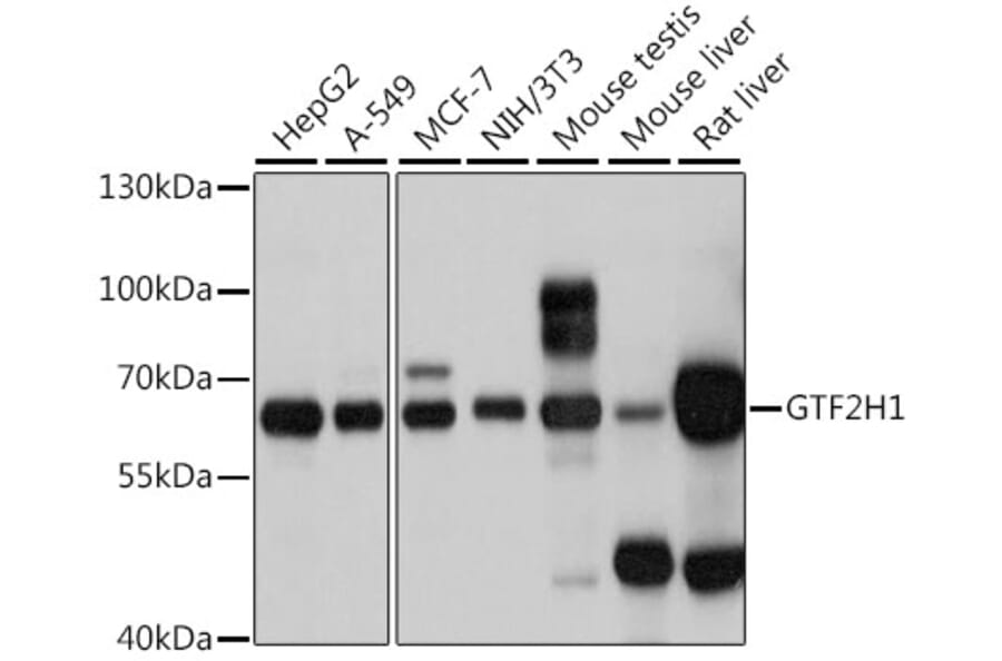 Western Blot - Anti-GTF2H1 Antibody (A15390) - Antibodies.com