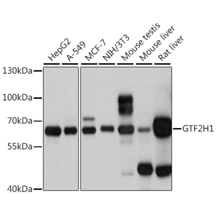 Western Blot - Anti-GTF2H1 Antibody (A15390) - Antibodies.com