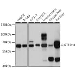 Western Blot - Anti-GTF2H1 Antibody (A15390) - Antibodies.com