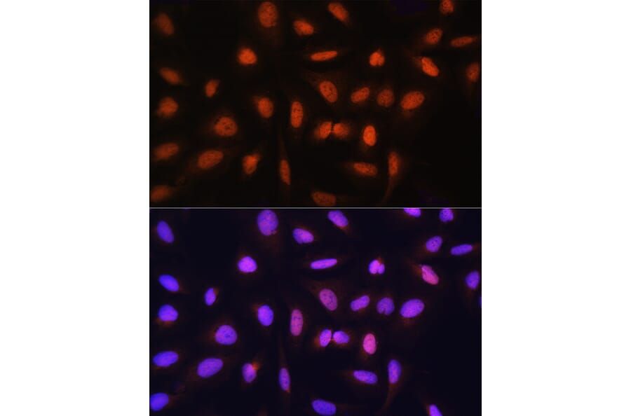 Immunofluorescence - Anti-GTF2H1 Antibody (A15390) - Antibodies.com