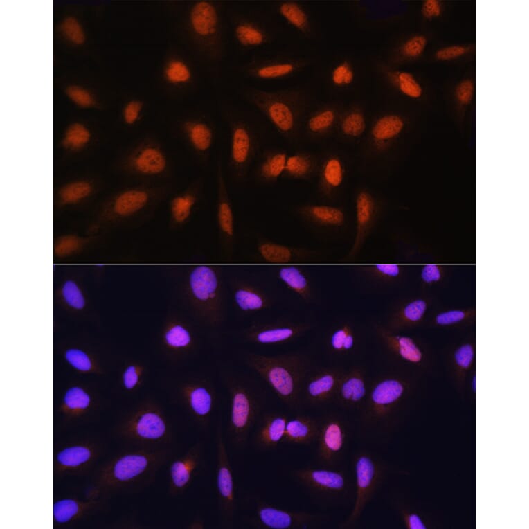 Immunofluorescence - Anti-GTF2H1 Antibody (A15390) - Antibodies.com