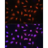 Immunofluorescence - Anti-GTF2H1 Antibody (A15390) - Antibodies.com