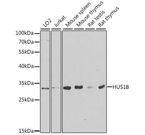 Western Blot - Anti-HUS1B Antibody (A6817) - Antibodies.com