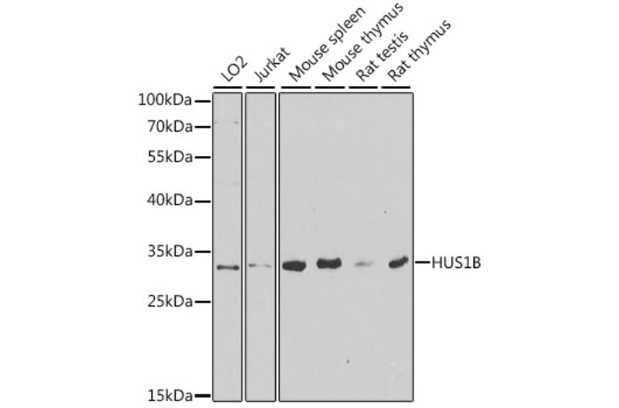 Western Blot - Anti-HUS1B Antibody (A6817) - Antibodies.com