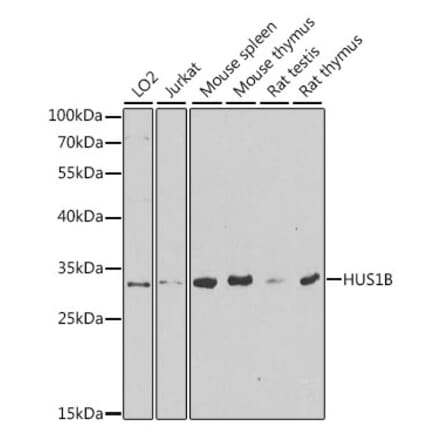 Western Blot - Anti-HUS1B Antibody (A6817) - Antibodies.com