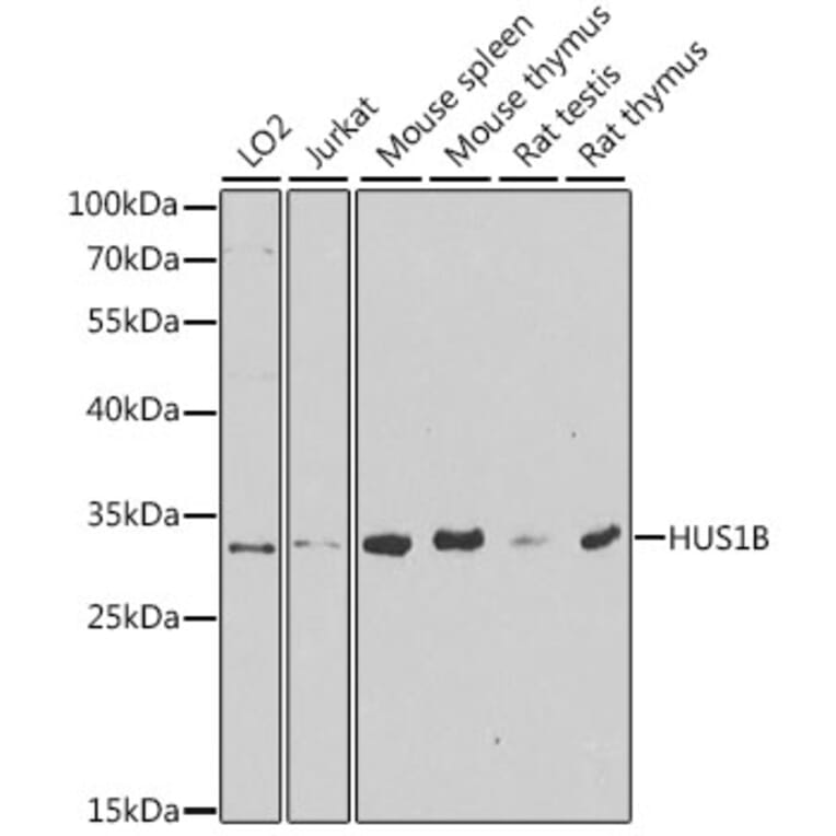 Western Blot - Anti-HUS1B Antibody (A6817) - Antibodies.com