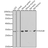 Western Blot - Anti-HUS1B Antibody (A6817) - Antibodies.com