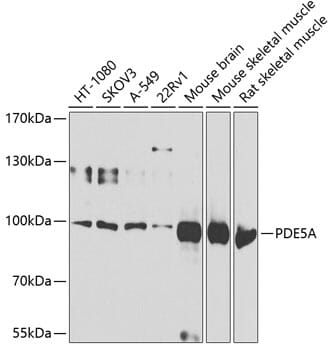 Western blot analysis of extracts of various cell lines, using Anti-PDE5A Antibody (A6831) at 1:1,000 dilution.
Secondary antibody: Goat Anti-Rabbit IgG (H+L) (HRP) (AS014) at 1:10,000 dilution.
Lysates / proteins: 25µg per lane.
Blocking buffer: 3% non-fat dry milk in TBST.
Detection: ECL Basic Kit (RM00020).
Exposure time: 60s.