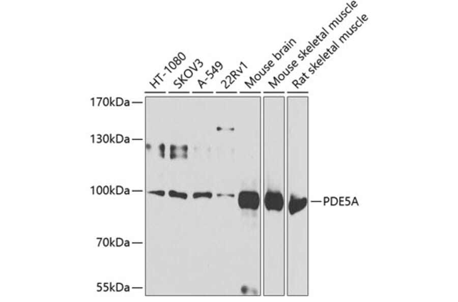 Western Blot - Anti-PDE5A/PDE5 Antibody (A15392) - Antibodies.com