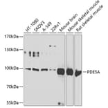 Western Blot - Anti-PDE5A/PDE5 Antibody (A15392) - Antibodies.com