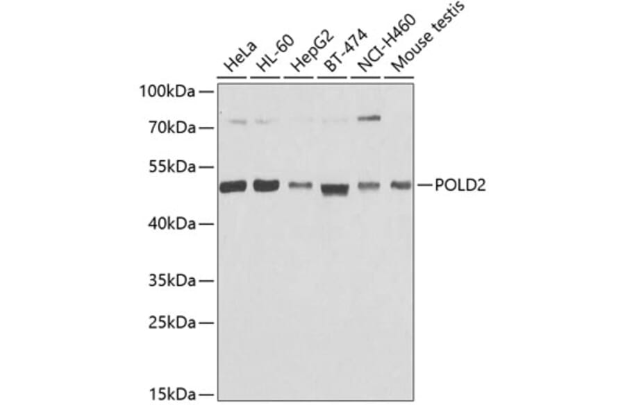 Western Blot - Anti-POLD2 Antibody (A15393) - Antibodies.com