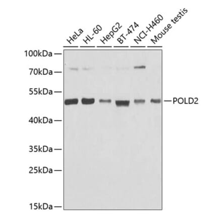 Western Blot - Anti-POLD2 Antibody (A15393) - Antibodies.com