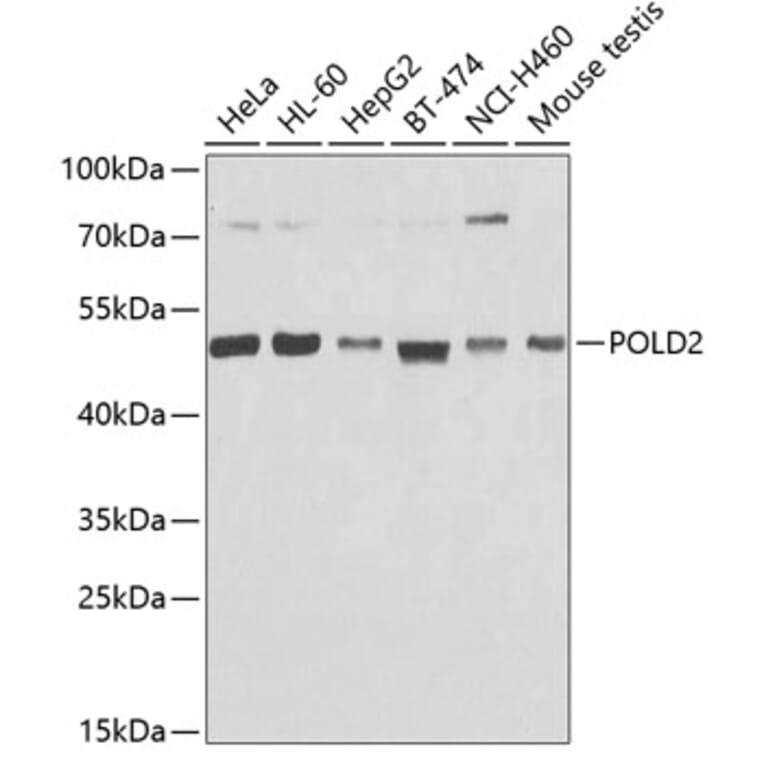 Western Blot - Anti-POLD2 Antibody (A15393) - Antibodies.com