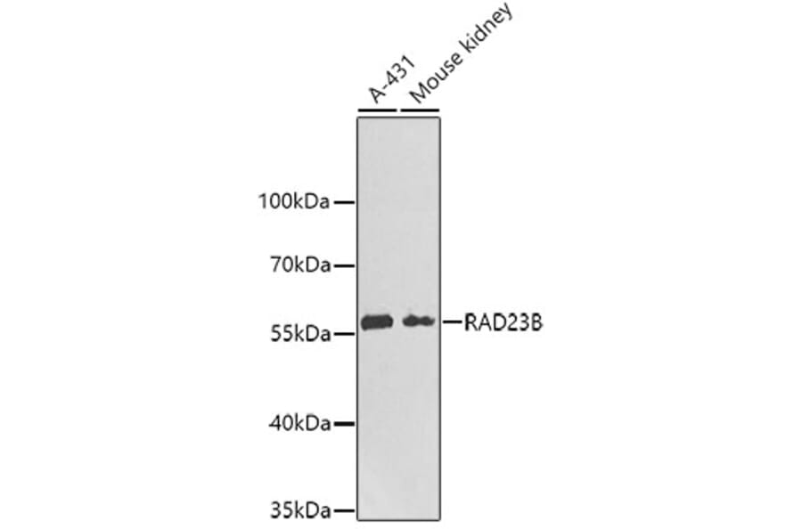 Western Blot - Anti-RAD23B Antibody (A6842) - Antibodies.com