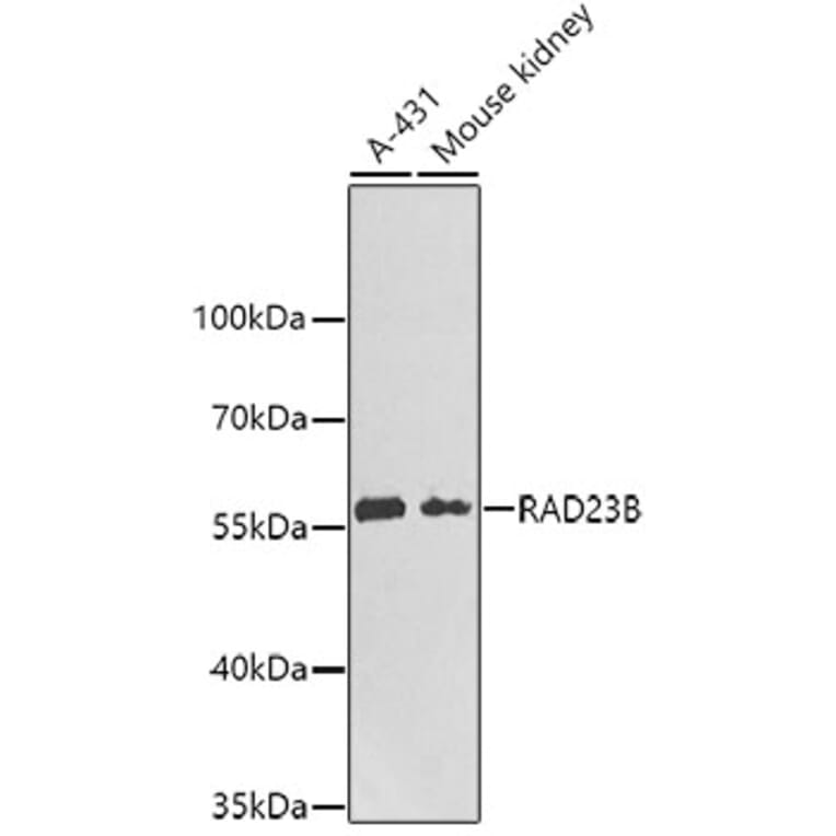Western Blot - Anti-RAD23B Antibody (A6842) - Antibodies.com