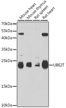 Western blot analysis of extracts of various cell lines, using Anti-UBE2T Antibody (A6853) at 1:1,000 dilution.
Secondary antibody: Goat Anti-Rabbit IgG (H+L) (HRP) (AS014) at 1:10,000 dilution.
Lysates / proteins: 25µg per lane.
Blocking buffer: 3% non-fat dry milk in TBST.
Detection: ECL Basic Kit (RM00020).
Exposure time: 90s.