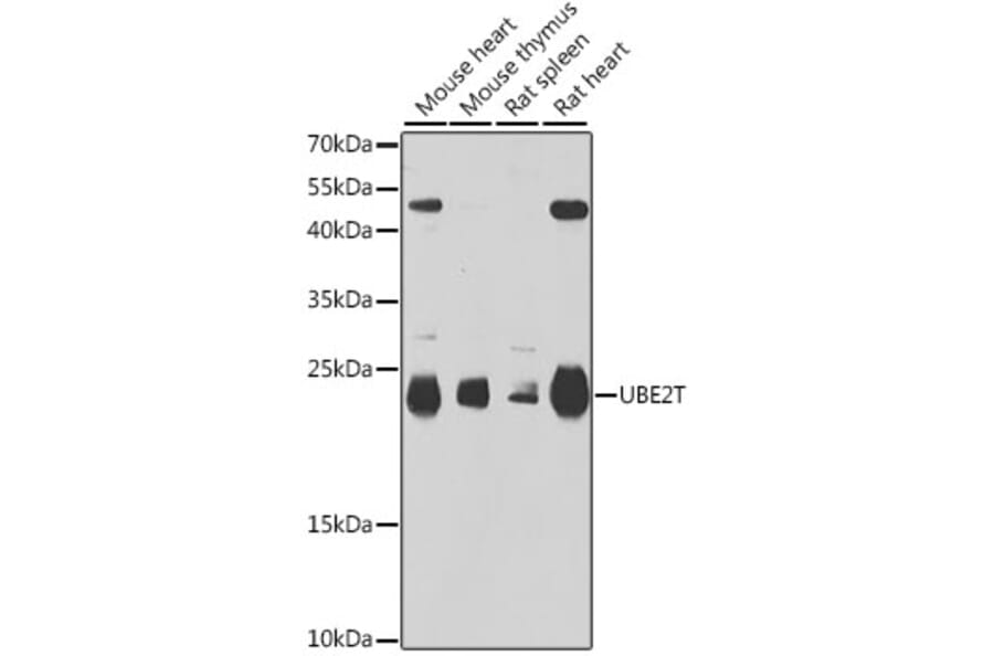 Western Blot - Anti-HSPC150/UBE2T Antibody (A15396) - Antibodies.com