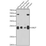 Western Blot - Anti-HSPC150/UBE2T Antibody (A15396) - Antibodies.com