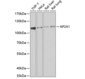 Western Blot - Anti-AP-2 complex subunit alpha-1 Antibody (A15399) - Antibodies.com