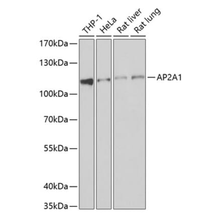 Western Blot - Anti-AP-2 complex subunit alpha-1 Antibody (A15399) - Antibodies.com